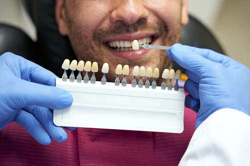 Dentist patient showing teeth to doctor with enamel samples