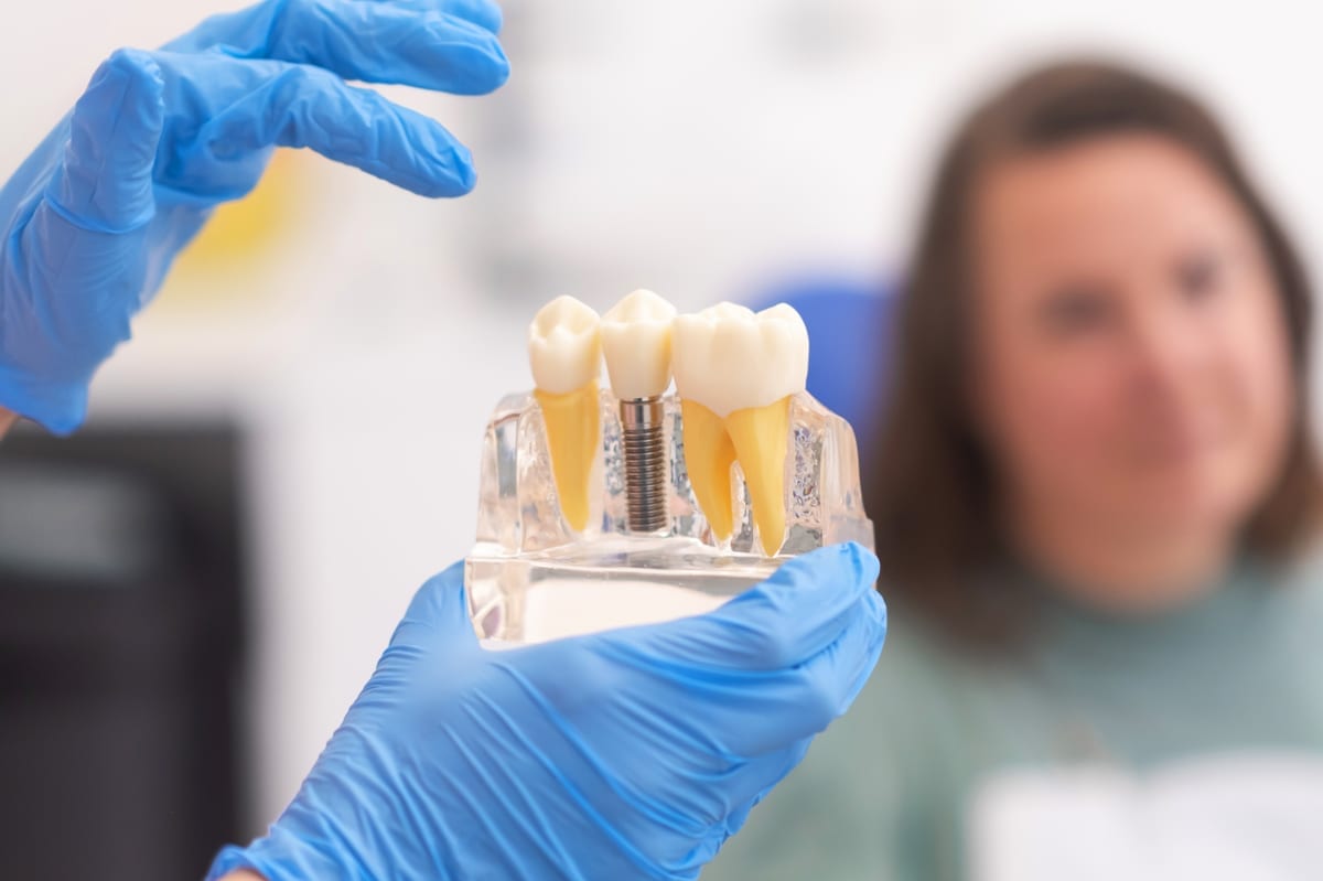 Dental Implants in Oklahoma City