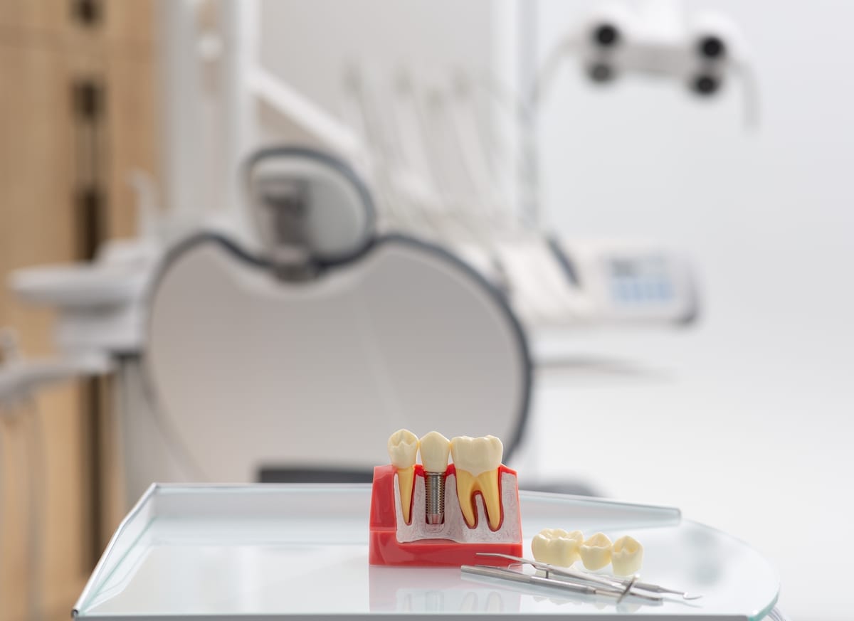 Dental Implants in Oklahoma City